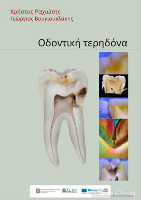 Οδοντική τερηδόνα